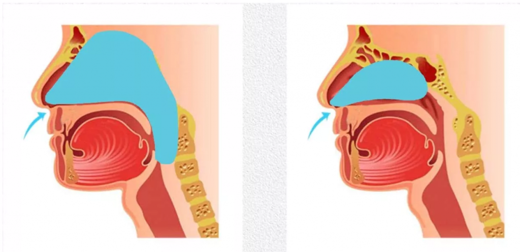 diagrama de fosas uso irrigador nasal guia